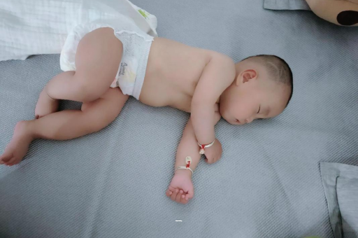 新疆宝宝脸上有白色斑块